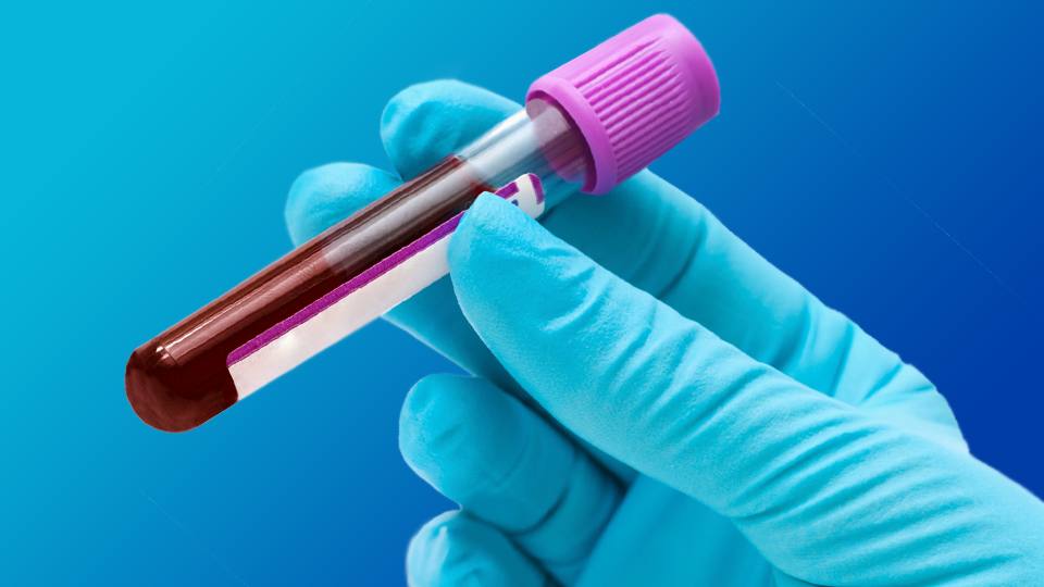 CDP Blood Lab passes annual compliance inspection – NDPC – National